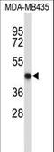 Nuclear Factor, Erythroid 2 antibody, LS-C164843, Lifespan Biosciences, Western Blot image 