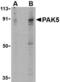 P21 (RAC1) Activated Kinase 5 antibody, NBP1-77237, Novus Biologicals, Western Blot image 