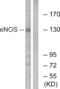 Nitric Oxide Synthase 3 antibody, LS-C118000, Lifespan Biosciences, Western Blot image 