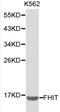 Fragile Histidine Triad Diadenosine Triphosphatase antibody, A01200-2, Boster Biological Technology, Western Blot image 