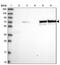 SAM And HD Domain Containing Deoxynucleoside Triphosphate Triphosphohydrolase 1 antibody, NBP2-47292, Novus Biologicals, Western Blot image 