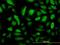 Ribonucleotide Reductase Regulatory Subunit M2 antibody, H00006241-M01, Novus Biologicals, Immunofluorescence image 