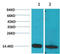 S100 Calcium Binding Protein B antibody, STJ97492, St John