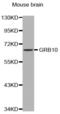 Growth Factor Receptor Bound Protein 10 antibody, abx000789, Abbexa, Western Blot image 