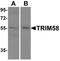 Tripartite Motif Containing 58 antibody, PA5-72893, Invitrogen Antibodies, Western Blot image 