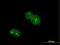 Zinc Finger Protein 32 antibody, H00007580-B01P, Novus Biologicals, Immunocytochemistry image 
