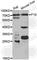 Coagulation Factor X antibody, A1452, ABclonal Technology, Western Blot image 