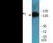 Inositol Polyphosphate-5-Phosphatase D antibody, EKC2179, Boster Biological Technology, Western Blot image 