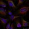 Nuclear Factor Kappa B Subunit 2 antibody, NB100-82063, Novus Biologicals, Immunofluorescence image 