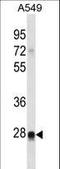 Ras Like Without CAAX 2 antibody, LS-C162617, Lifespan Biosciences, Western Blot image 