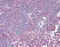 Zeta Chain Of T Cell Receptor Associated Protein Kinase 70 antibody, 49-036, ProSci, Immunohistochemistry paraffin image 