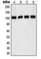 Probable G-protein coupled receptor 110 antibody, MBS822048, MyBioSource, Western Blot image 