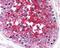 Basigin (Ok Blood Group) antibody, 49-100, ProSci, Immunohistochemistry paraffin image 