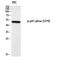 Neutrophil Cytosolic Factor 1 antibody, STJ91180, St John