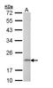 Adaptor Related Protein Complex 1 Subunit Sigma 2 antibody, LS-B8922, Lifespan Biosciences, Western Blot image 