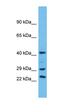 Ubiquitin Specific Peptidase 41 antibody, orb327143, Biorbyt, Western Blot image 