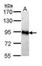 Adenosine Monophosphate Deaminase 2 antibody, GTX112483, GeneTex, Western Blot image 