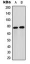 Forkhead Box O1 antibody, abx121396, Abbexa, Western Blot image 