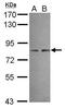 Adaptor Protein, Phosphotyrosine Interacting With PH Domain And Leucine Zipper 2 antibody, PA5-30669, Invitrogen Antibodies, Western Blot image 