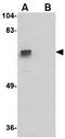 Zinc Finger Protein 350 antibody, GTX31362, GeneTex, Western Blot image 