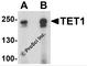 Tet Methylcytosine Dioxygenase 1 antibody, 7733, ProSci, Western Blot image 