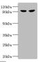 Glycogen Phosphorylase L antibody, A53440-100, Epigentek, Western Blot image 