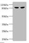 Glycogen phosphorylase, liver form antibody, A53440-100, Epigentek, Western Blot image 