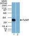 Thioredoxin Interacting Protein antibody, NBP2-27095, Novus Biologicals, Western Blot image 
