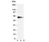 ADAM Metallopeptidase Domain 10 antibody, R30611, NSJ Bioreagents, Western Blot image 
