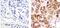 Cadherin 1 antibody, MA5-14458, Invitrogen Antibodies, Immunohistochemistry paraffin image 