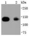 Histone Deacetylase 4 antibody, NBP2-67782, Novus Biologicals, Western Blot image 