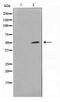 SPT3 Homolog, SAGA And STAGA Complex Component antibody, TA347626, Origene, Western Blot image 