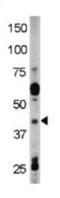 RAD9 Checkpoint Clamp Component A antibody, abx031904, Abbexa, Western Blot image 