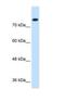 Salt Inducible Kinase 1 antibody, NBP1-53156, Novus Biologicals, Western Blot image 