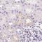 Insulin Like Growth Factor Binding Protein 1 antibody, PA5-62226, Invitrogen Antibodies, Immunohistochemistry frozen image 