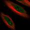 Cyclin Dependent Kinase Inhibitor 1C antibody, NBP1-89917, Novus Biologicals, Immunofluorescence image 