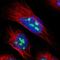 PLA2-R antibody, NBP1-84449, Novus Biologicals, Immunocytochemistry image 