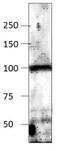 Adenylate Cyclase 9 antibody, GTX14783, GeneTex, Western Blot image 