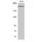 Sodium Voltage-Gated Channel Alpha Subunit 1 antibody, LS-C384748, Lifespan Biosciences, Western Blot image 