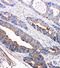 Tyrosine-protein kinase Tec antibody, PA2000, Boster Biological Technology, Immunohistochemistry frozen image 