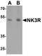 NK-3R antibody, A04916, Boster Biological Technology, Western Blot image 