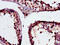 Glutathione S-Transferase Mu 3 antibody, CSB-PA009982LA01HU, Cusabio, Immunohistochemistry frozen image 