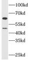 Choline O-Acetyltransferase antibody, FNab01632, FineTest, Western Blot image 