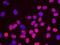 Minichromosome Maintenance Complex Component 2 antibody, GTX24461, GeneTex, Proximity Ligation Assay image 