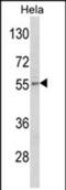 Gasdermin E antibody, PA5-72478, Invitrogen Antibodies, Western Blot image 