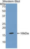 TGF beta antibody, LS-C296762, Lifespan Biosciences, Western Blot image 