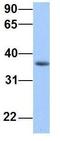 ERI1 Exoribonuclease Family Member 2 antibody, GTX45767, GeneTex, Western Blot image 