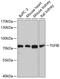 Transforming Growth Factor Beta Induced antibody, GTX16415, GeneTex, Western Blot image 