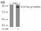 Signal Transducer And Activator Of Transcription 5A antibody, 79-125, ProSci, Western Blot image 