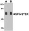 Sphingolipid Transporter 1 (Putative) antibody, TA326706, Origene, Western Blot image 